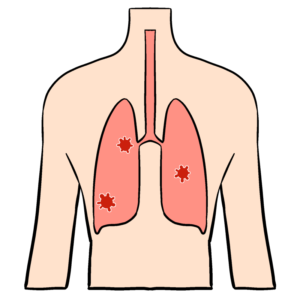 人体・ウィルスに脅かされる肺